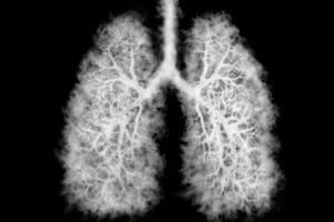 THC Vape Oil Vials Linked to Dangerous Lung Illnesses