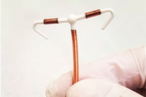 Paragard iud removal injury lawsuit lawyers