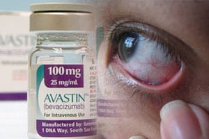 Avastin-Unit-Dose-Syringes-Serious-Eye-Infection
