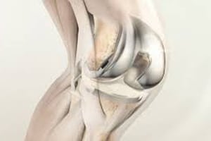 Class-2-Recall-Issued-for-DePuy-Synthes-Knee-Implant