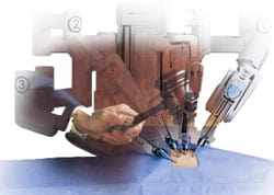 Consolidation Proposed for da Vinci Surgical Robot Lawsuits