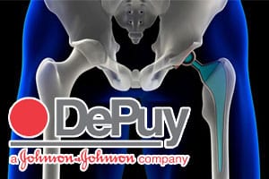 DePuy_Implants+Flawed