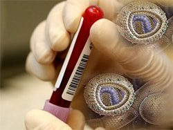 Feds Join Probe of New Hampshire Hepatitis C Outbreak