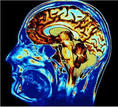 Increase_in_Emergency_Visits_for_Traumatic_Brain_Injuries