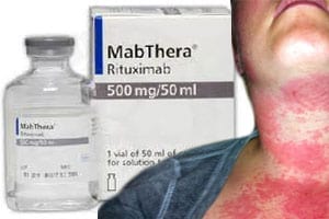 Mabthera-Skin-Reactions