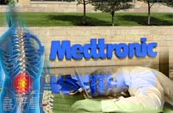 Medtronic Plans Layoffs, as Infuse Bone Graft Controversy Continues to Weigh on Spinal Business