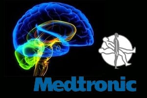 Medtronic_Brain
