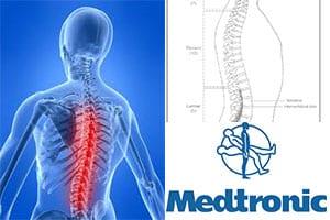 Medtronic_Spinal_Cuts