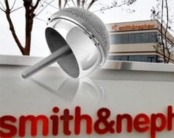 Smith & Nephew’s Birmingham Metal-on-Metal Hip Replacement Device