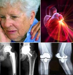 Older Hip Implant, Knee Replacement Patients Face Heart Attack Risk Following Surgery