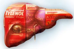Using Acetaminophen Safely to Avoid Liver Damage, Other Side Effects