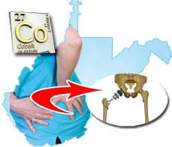West Virginia Man Claims Metal-on-Metal DePuy Pinnacle Hip Replacement Led to Pain, Elevated Cobalt Levels