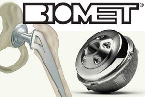 biomet-magnum-implant-revision-surgery-lawsuit