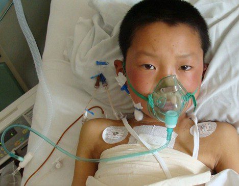 children-heart-disease-radiation-risks-of-cancer