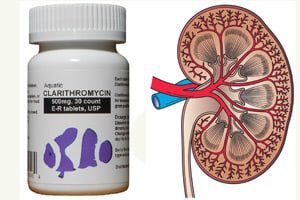 clarithromycin-kidney-risk