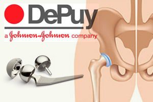 depuy-pinnacle-hip-implant-revision
