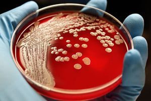 drug_resistant_superbug_dangers