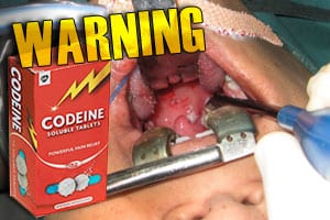 fda-warns-use-codeine-tonsillectomy