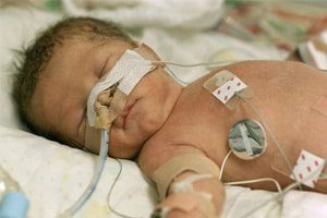Pfizer Scientist Warned of Link between Zoloft & Birth Defects