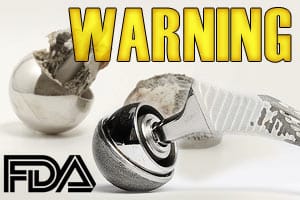 metal on metal fda rules