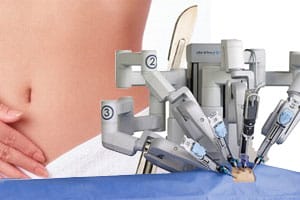 obgyn-robotic-hysterectomy