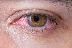 Honeywell Issues Recall for Contaminated Eyesaline Eyewash