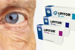 statins_cataracts_link