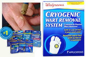 wart-removal-products-fire-risk