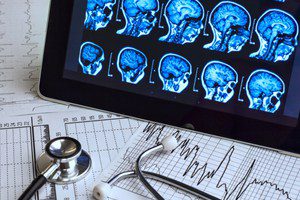 Deadly error compels recall of brain scan device