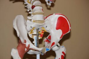 Hip Replacement Surgery and Implants