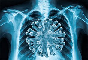 Vaping causes a coronavirus-like lung illness 