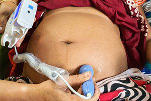Study shows maternal mortality rising in the u.s.
