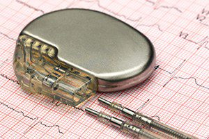 Boston scientific pacemaker recalls