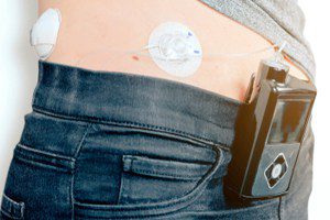 Medtronic minimed 600 series insulin pump claims