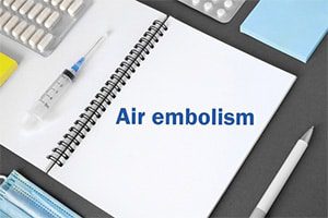 Steerable Delivery Sheath Air Embolism Lawsuits